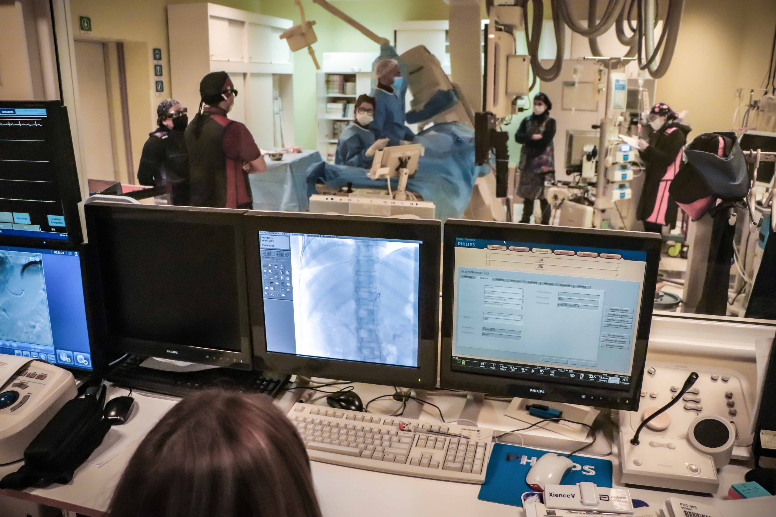 Equipo del Hospital Regional realiza su primera embolización hepática a paciente con cáncer al hígado